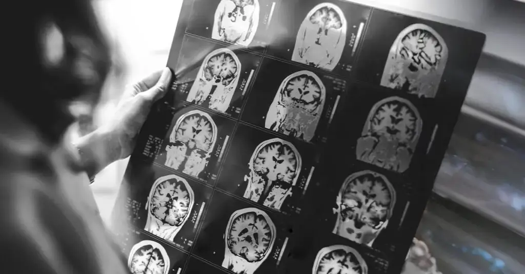 Delivering-depth-detail-neurology-deserves